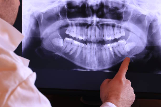 Best Chipped Tooth Repair Near Me  in Cadiz, OH