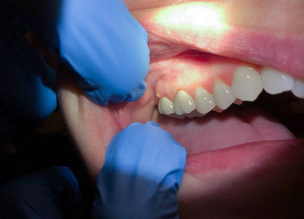 Best Emergency Gum Pain Relief  in Cadiz, OH