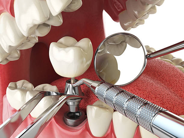 Best Tooth Infection Emergency Dentist  in Cadiz, OH